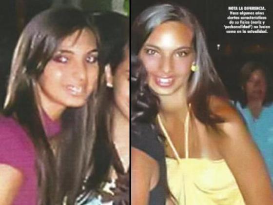 Noticia-110017-esto_es_guerra-natalie_vertiz-fotos-antes-despues-cirugia-5.jpg