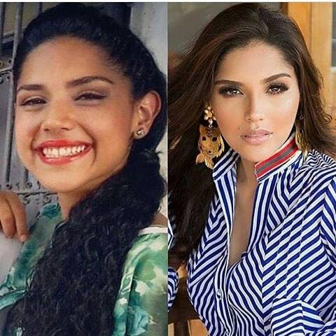 No era tan fea la gordita en reposo antes de sus cirugías