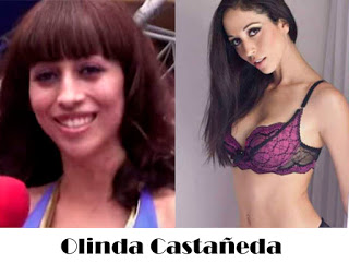 olinda-castaneda-antes-y-despues-de-las-cirugias.jpg.c93c5b3983317ac3f01fe91162dd9235.jpg