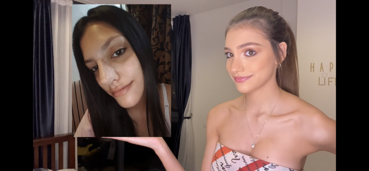 La nueva youtuber Valentina Figuera(Miss Grand 2019) revela todas sus cirugias plasticas