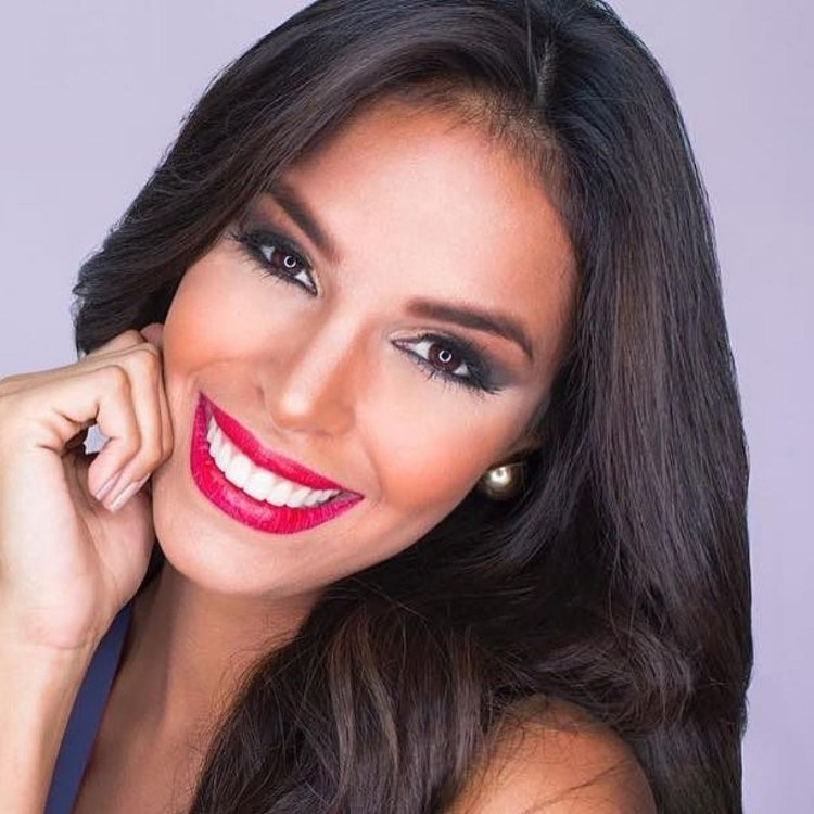EX MISS VENEZUELA MUESTRA ORGULLOSA IMPERFECCIONES EN SU CUERPO.