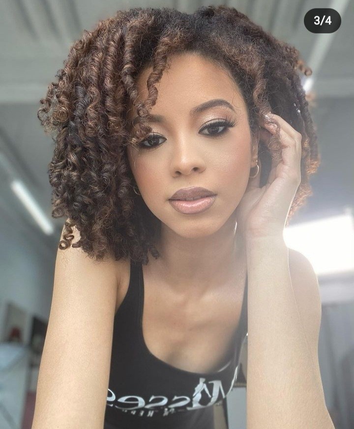 Las  cirugías de andreina martinez