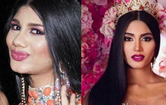 miss-venezuela-cirugia.jpg
